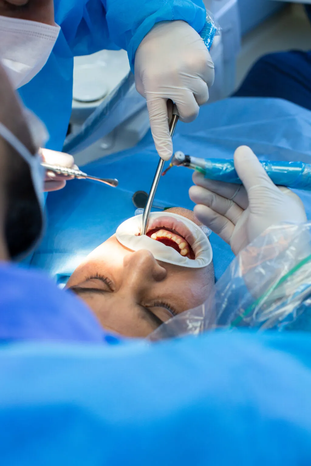 Tratamiento dental de primer plano con instrumental estético