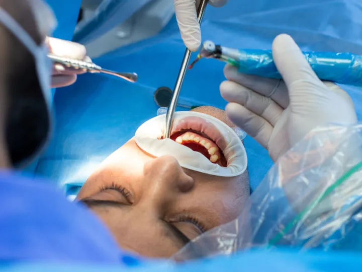 Tratamiento dental de primer plano con instrumental estético